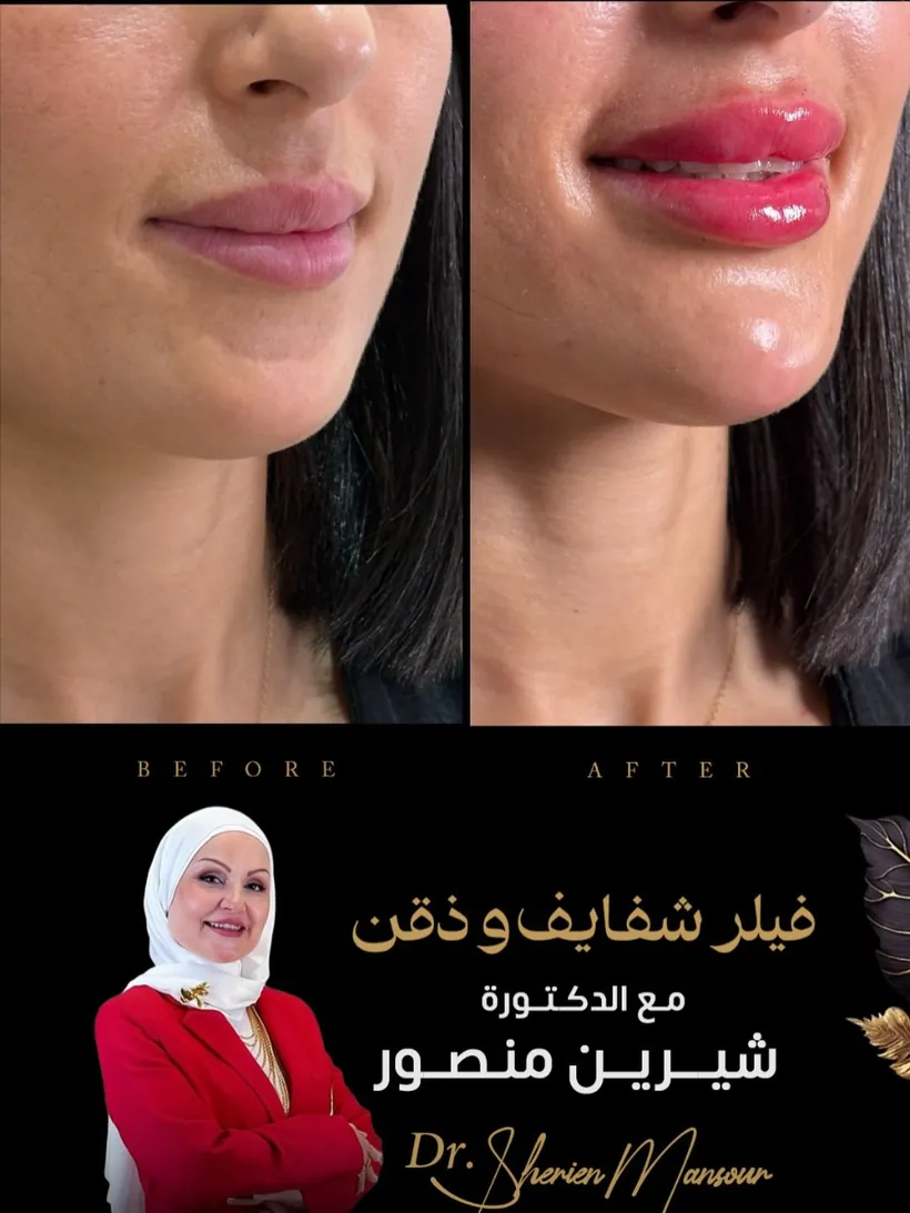 نتيجة